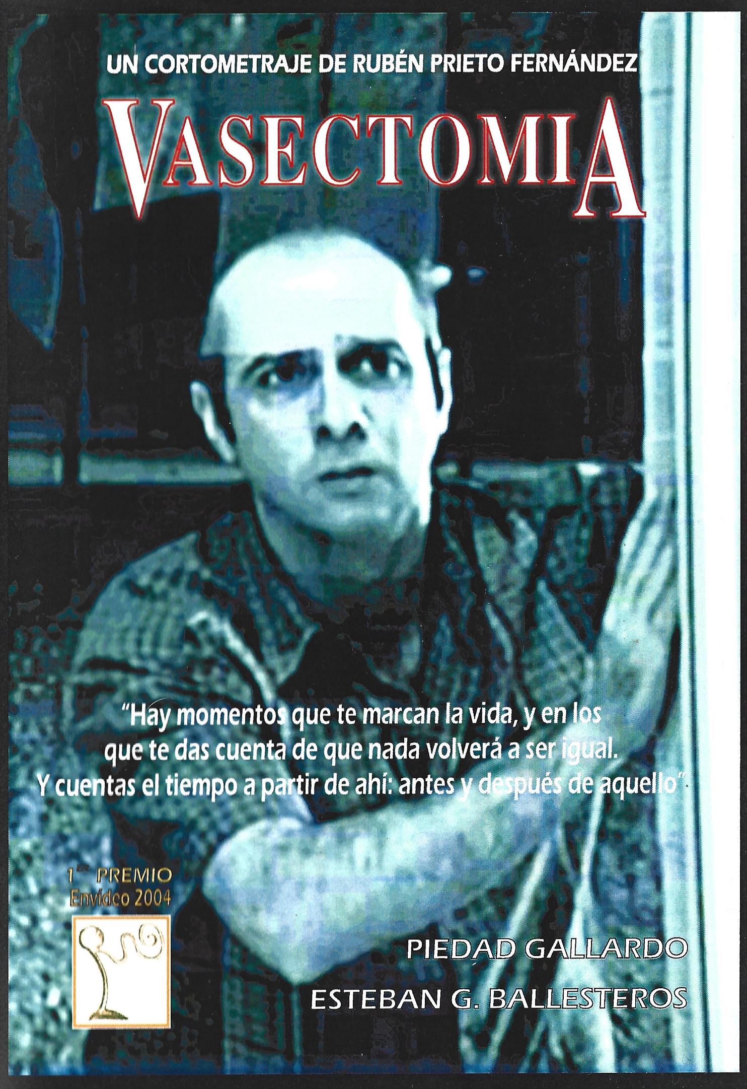 Vasectomía